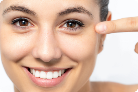 Krähenfüße (Lachfältchen) - Botulinumtoxin (z.B. Botox®)