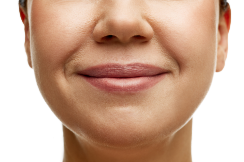 Nasolabialfalte - Skinbooster