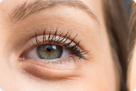 Unterlidfalten - Botulinumtoxin (z.B. Botox®)